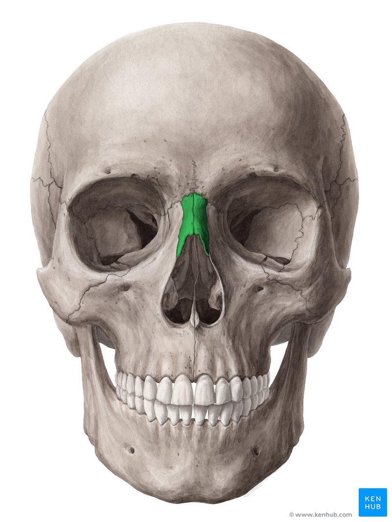 Osso nasal (verde) – vista anterior