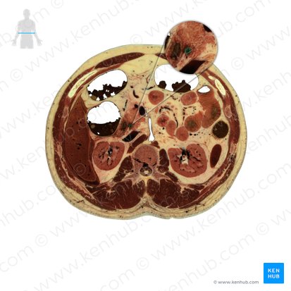 Conducto colédoco (Ductus biliaris); Imagen: National Library of Medicine