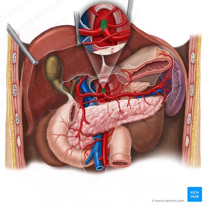 Celiac trunk (Truncus coeliacus); Image: Esther Gollan