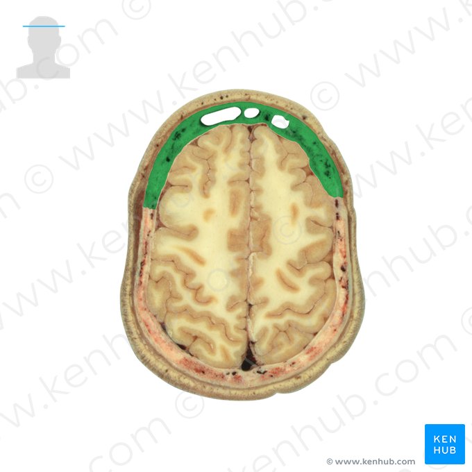 Frontal bone (Os frontale); Image: National Library of Medicine