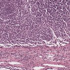 Reticular connective tissue