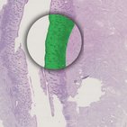 Embryology: 2nd week of development