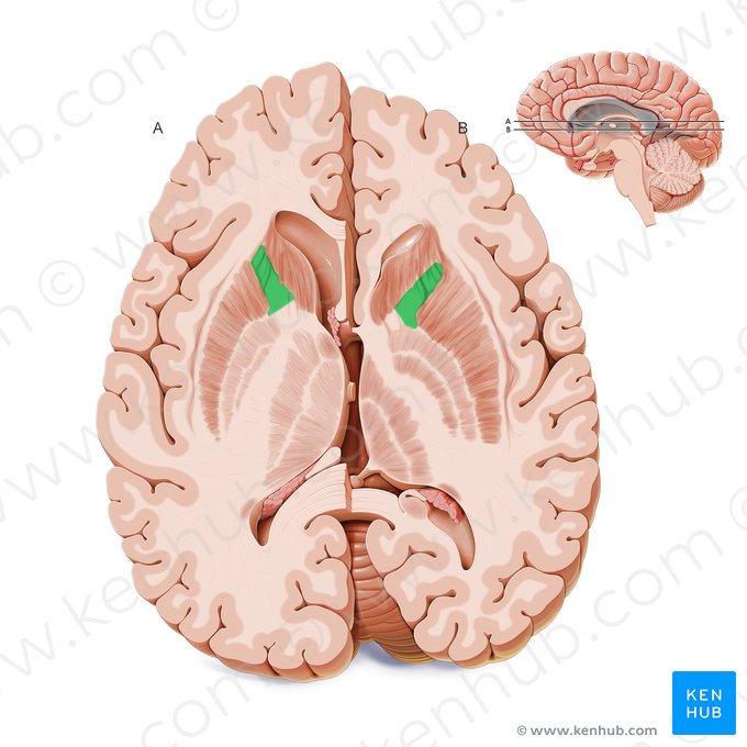 Crus anterius capsulae internae (Vorderer Schenkel der inneren Kapsel); Bild: Paul Kim