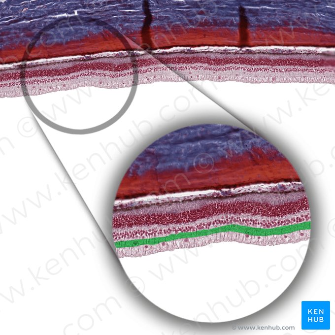 Capa plexiforme interna (Stratum plexiforme internum retinae); Imagen: 