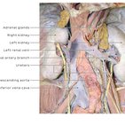 Clinical case: Horseshoe kidney transplantation