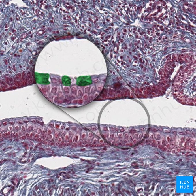 Umbrella cells (Urotheliocyti superficiales); Image: 