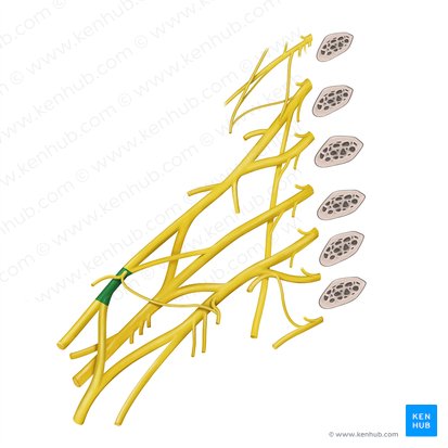Fasciculus lateralis plexus brachialis (Seitliches Bündel des Armgeflechts); Bild: Begoña Rodriguez