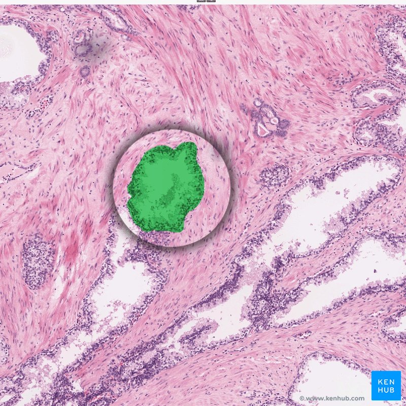 Prostatic acinus - Histology