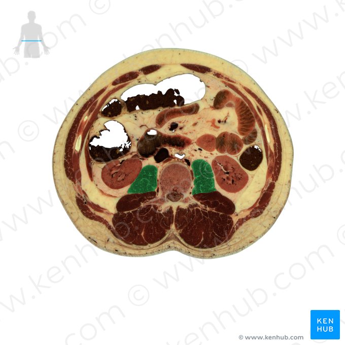 Músculo psoas maior (Musculus psoas major); Imagem: National Library of Medicine