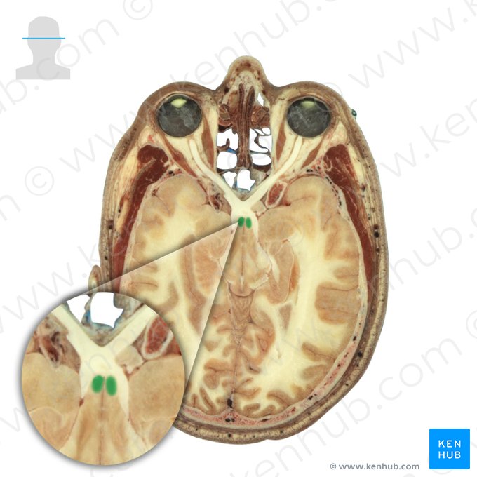 Fornix; Image: National Library of Medicine