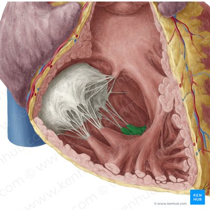Musculus papillaris inferior ventriculi dextri (Hinterer Papillarmuskel der rechten Herzkammer); Bild: Yousun Koh
