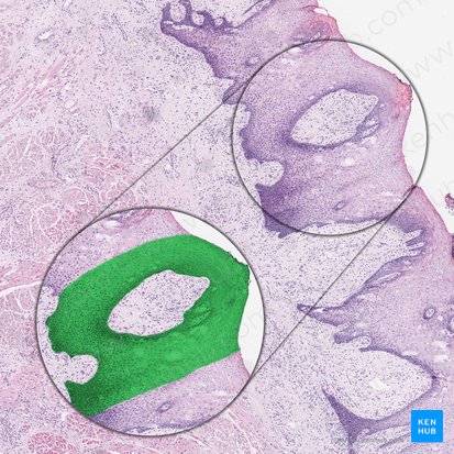 Nonkeratinized stratified squamous epithelium (Epithelium stratificatum squamosum non cornificatum); Image: 