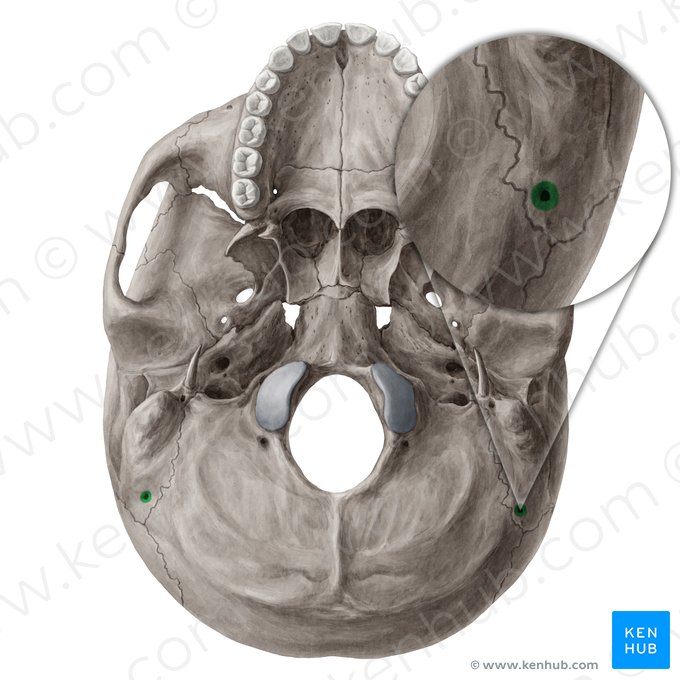 Foramen mastoideo del hueso temporal (Foramen mastoideum); Imagen: Yousun Koh