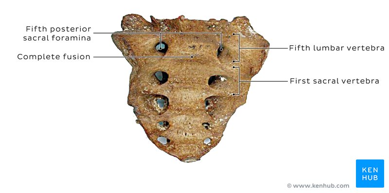 L5 sacralization