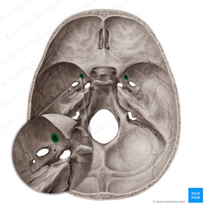 Forame redondo (Foramen rotundum); Imagem: Yousun Koh