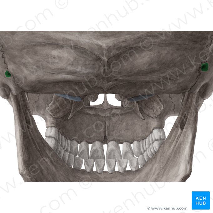 Foramen mastoideo del hueso temporal (Foramen mastoideum); Imagen: Yousun Koh