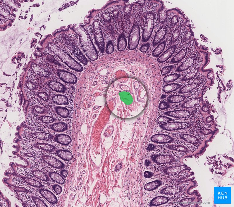 Lymphatic vessel - histological slide