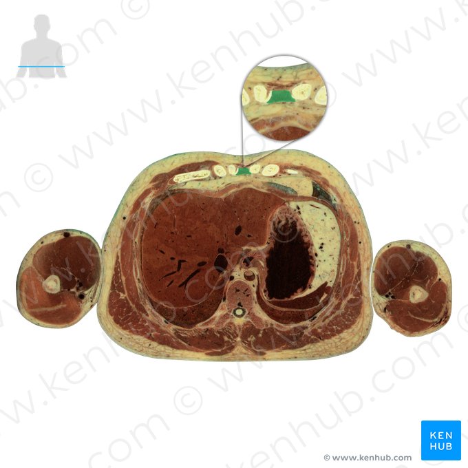 Esterno (Sternum); Imagem: National Library of Medicine