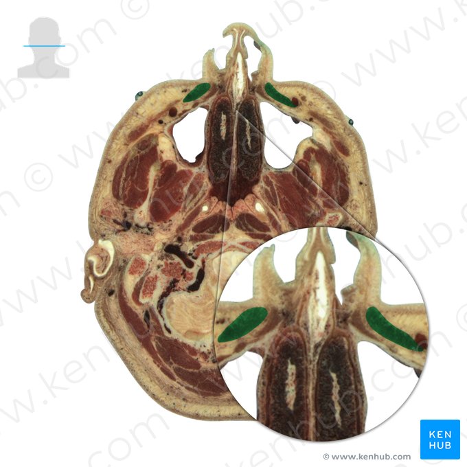 Musculus levator labii superioris (Oberlippenheber); Bild: National Library of Medicine