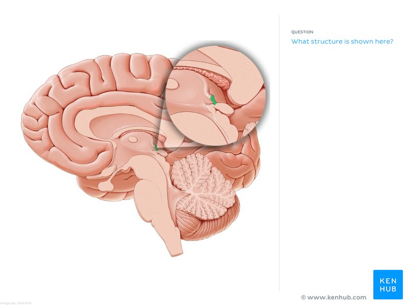 8 steps to create your own anatomy flashcards Kenhub