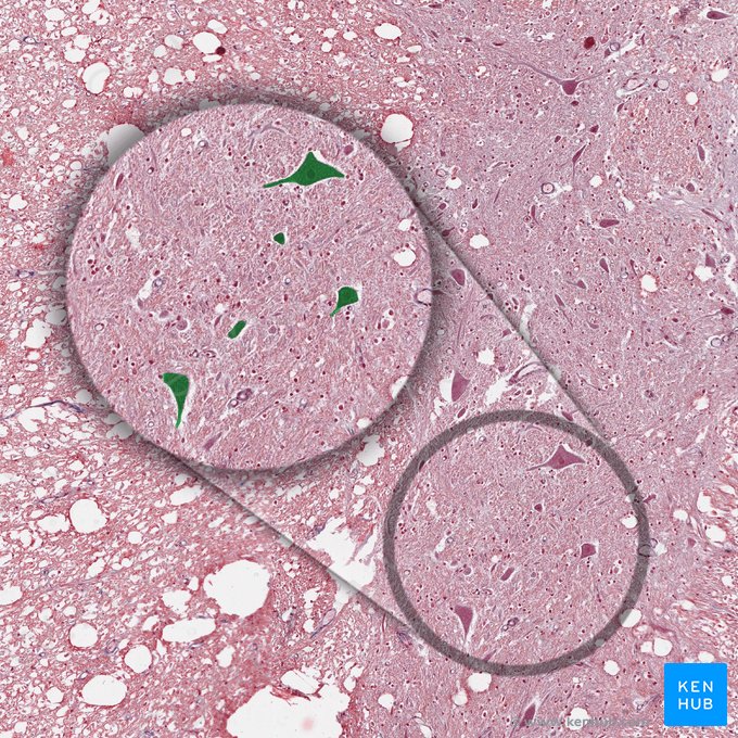 Cuerpo de la neurona motora (Soma motoneuronis); Imagen: 