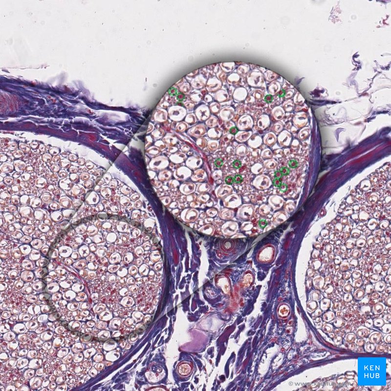 Unmyelinated fibers - histological slide