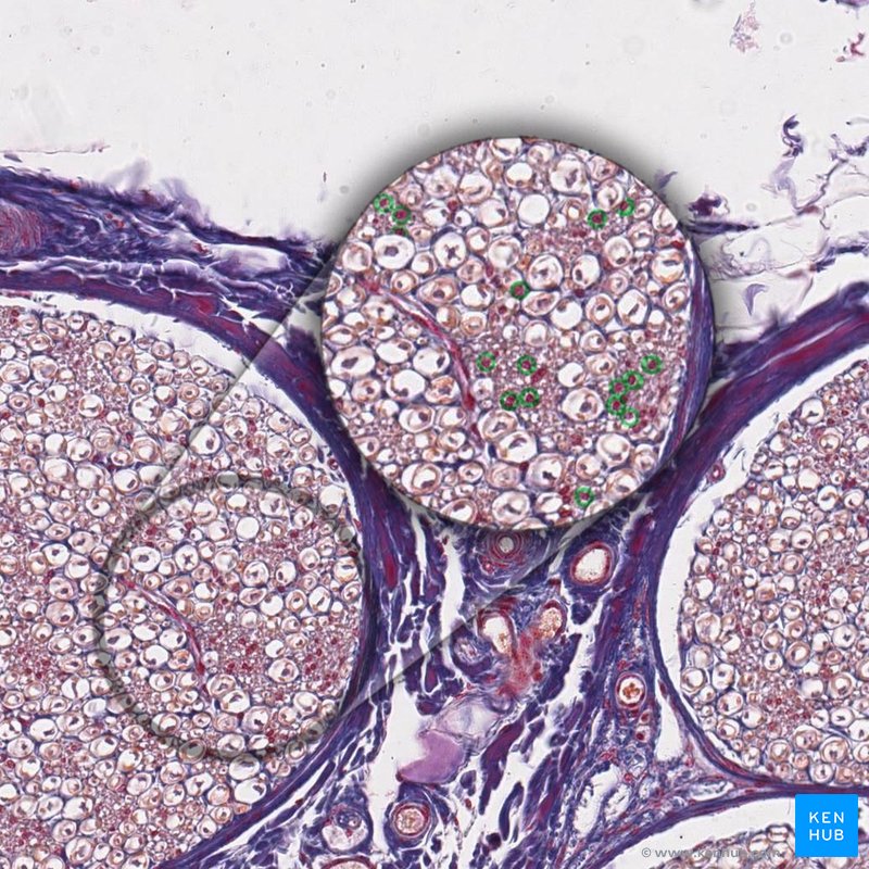 Unmyelinated fibers - histological slide