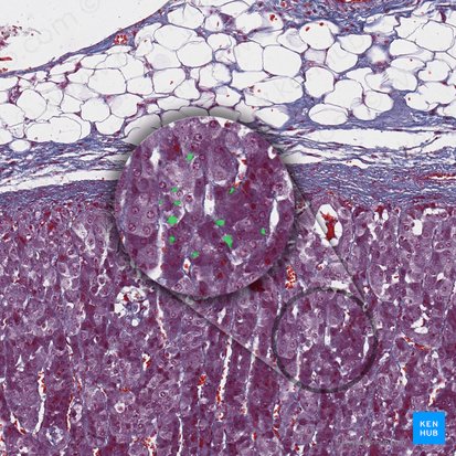 Lipidtropfen; Bild: 