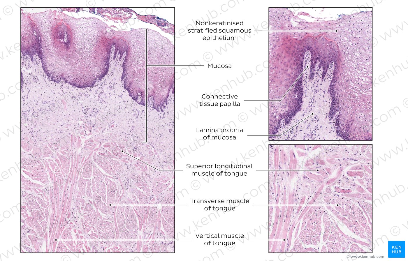 Dorsal surface of tongue in section. Stain: H&E. Medium magnification.