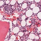 Histologia da medula óssea