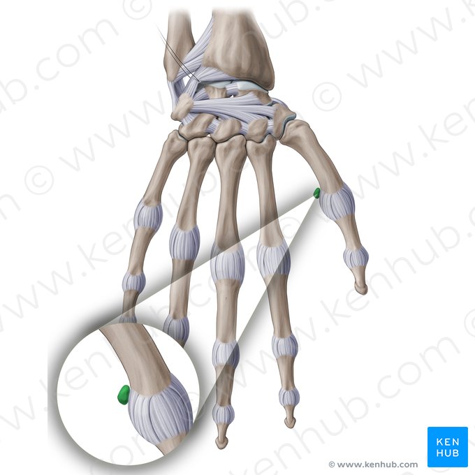Os sesamoideum ulnare articulationis metacarpophalangeae pollicis (Ellenseitiges Sesambein des Daumens); Bild: Paul Kim