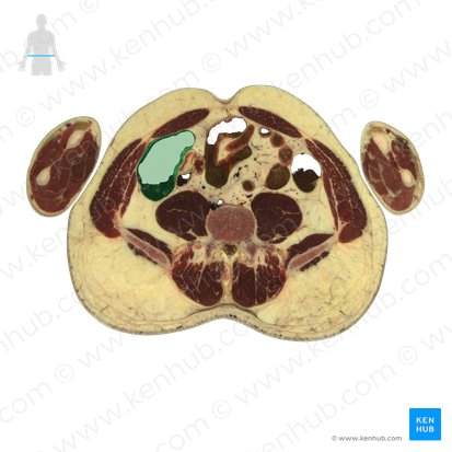 Ascending colon (Colon ascendens); Image: National Library of Medicine