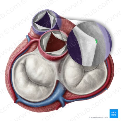 Nodules of semilunar leaflets of pulmonary valve (Noduli valvularum semilunarium valvae trunci pulmonalis); Image: Yousun Koh