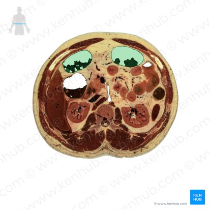 Transverse colon (Colon transversum); Image: National Library of Medicine