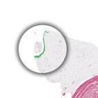 Mesothel