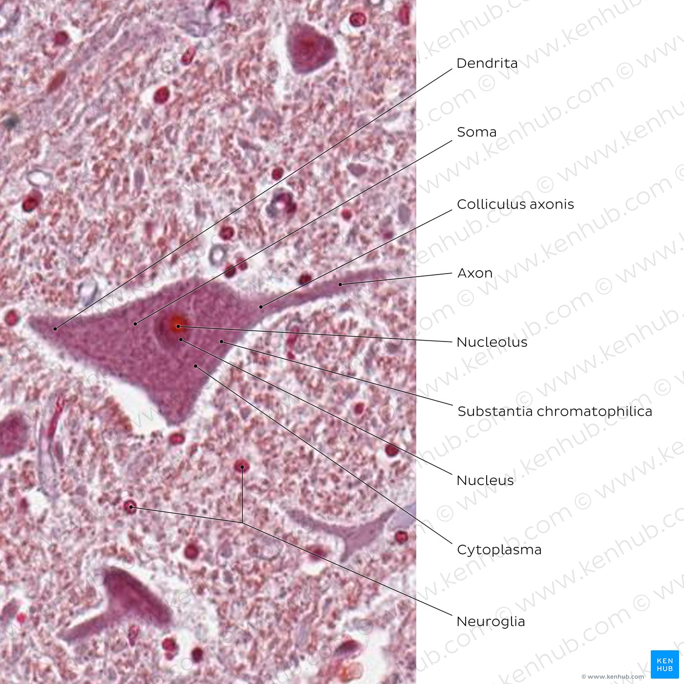 Multipolar neuron