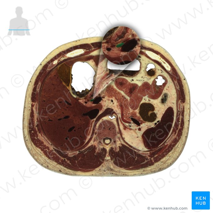 Bile duct (Ductus biliaris); Image: National Library of Medicine