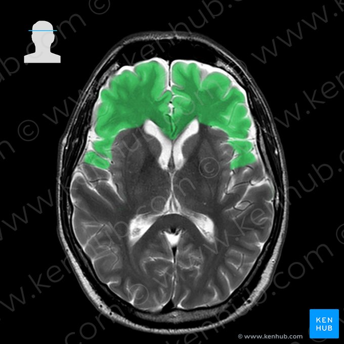 Lobo frontal (Lobus frontalis); Imagem: 