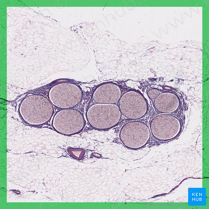 Cross section of peripheral nerve; Image: 
