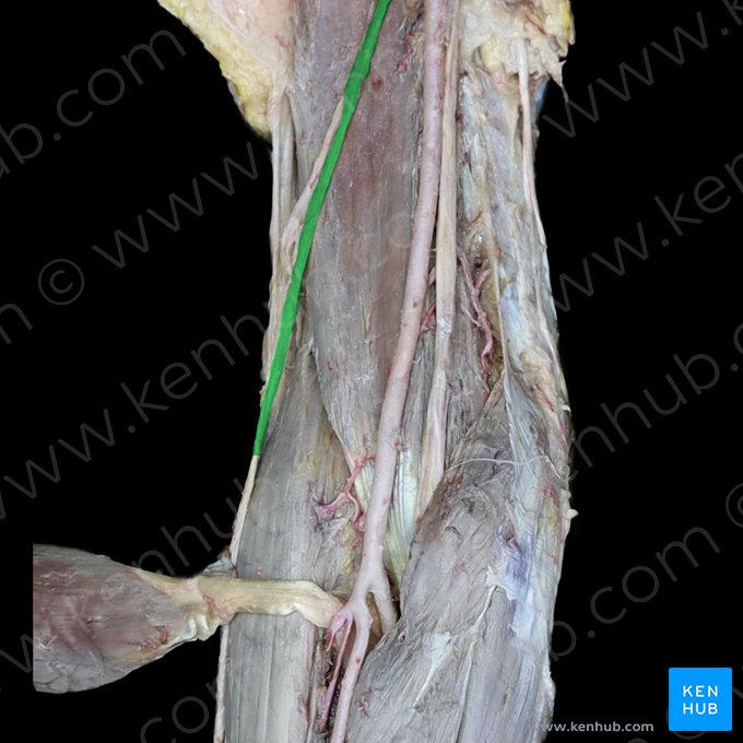 Nervus musculocutaneus (Muskel-Haut-Nerv); Bild: 