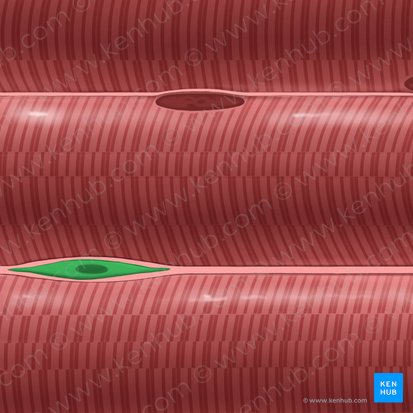 Fibroblasto (Fibroblastus); Imagem: Tal Bavli Ziv