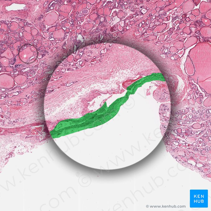 Cápsula (Capsula); Imagen: 