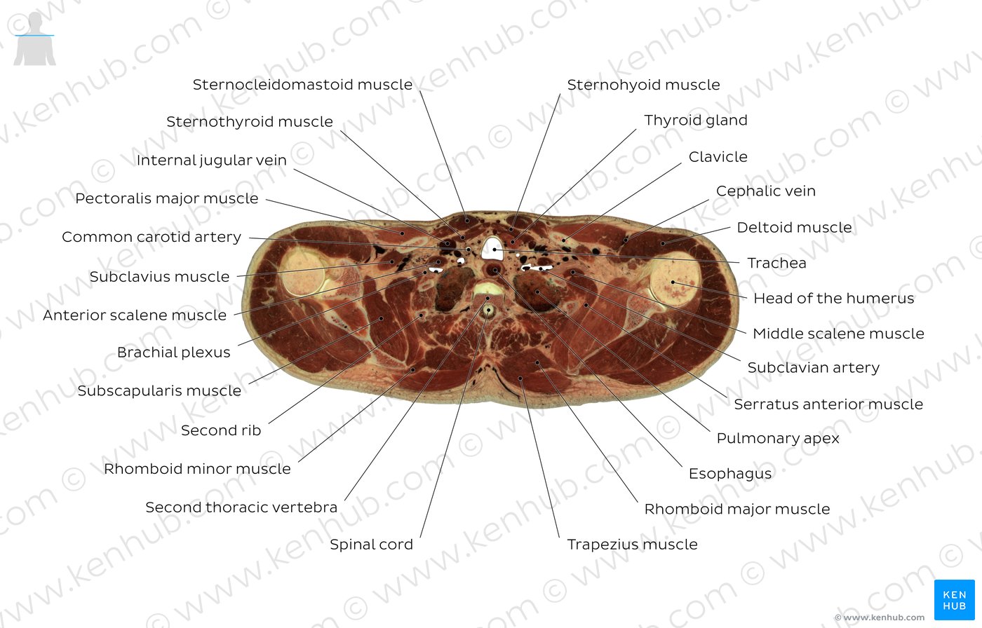 Second thoracic vertebra level: Overview