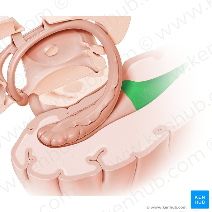 Corno occipital do ventrículo lateral (Cornu occipitale ventriculi lateralis); Imagem: Paul Kim