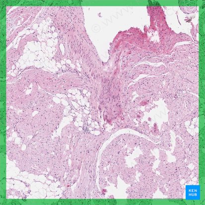 Sistema de conducción del corazón (Complexus stimulans cordis); Imagen: 