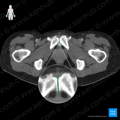 Pubic symphysis (Symphysis pubica); Image: 