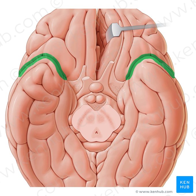 Lateral sulcus (Sulcus lateralis); Image: Paul Kim