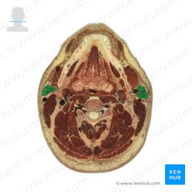 Glándula parotida (Glandula parotidea); Imagen: National Library of Medicine