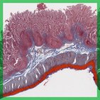 Ileum - Histologie