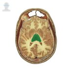 Anatomia seccional: secções transversais do corpo humano